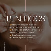 Beneficios del peeling MH Beauty Center